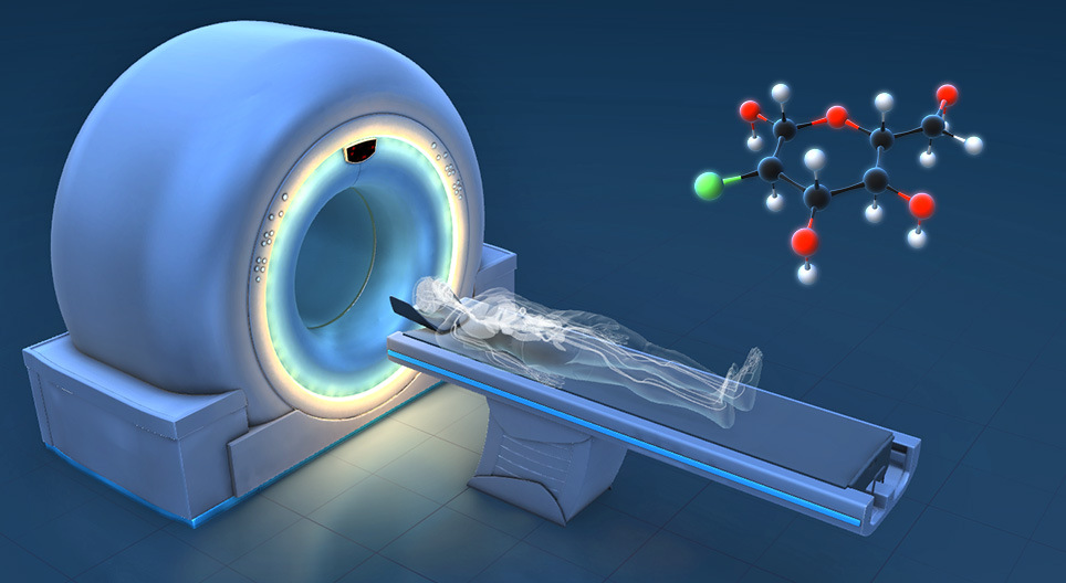 How does it work? - PET-CT