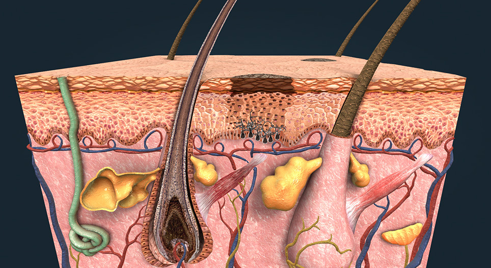 Bronceado, cáncer de piel