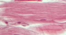 Tendão (secção longitudinal)