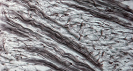 Tecido de fibrocartilagem (nariz de embrião de porco)