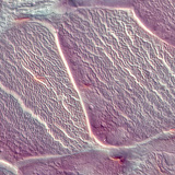 Tendão (corte transversal)