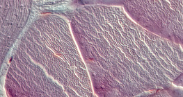 Tendão (secção transversal)