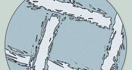 Imagem microscópica de uma gaze