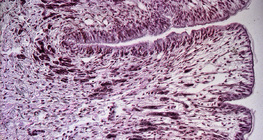 Seção transversal do pé de caracol