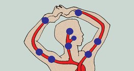 Pressure points used to stop arterial bleeding