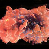 HIV vírussal (kék) fertőzött fehérvérsejt