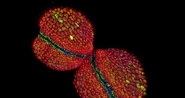 Saco de pólen de flores Mirabilis (microscópio confocal de varredura a laser)