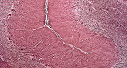 Seção do cerebelo humano