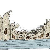Ciliated epithelium of a smoker's respiratory tract