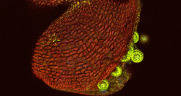 Saco de pólen Mirabilis, aberto (microscópio confocal de varredura a laser)