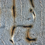 Osso (corte longitudinal)