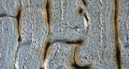 Osso (seção longitudinal)