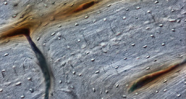 Osso (seção longitudinal)