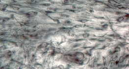 Tecido conjuntivo frouxo