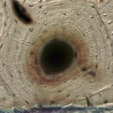 Bone (cross section)
