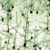 Neurónios do córtex cerebral