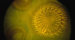 Skylex de tênia (cabeça) ganchos e ventosas