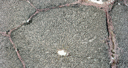 Seção de fígado (porco)