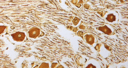 Células nervosas no gânglio espinhal