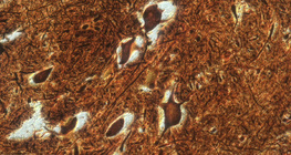 Células nervosas na medula espinhal (bovinos)