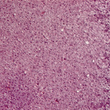 Corte transversal de la glándula suprarrenal