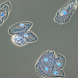 Células de la mucosa en la cavidad bucal humana