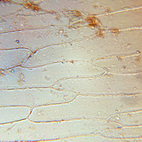 Células das carnudas folhas escamosas de uma cebola