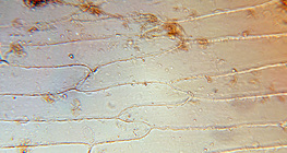 Células da escala carnuda folhas de uma cebola