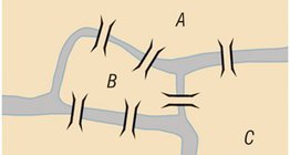 As sete pontes de Königsberg