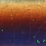 Bactérias E. coli fluorescentes de um cabelo Bactérias E. coli fluorescentes de um cabelo