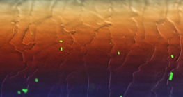 Bactérias fluorescentes de E. coli no cabelo