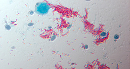 Patógeno de la tuberculosis (TBC) (Mycobacterium tuberculosis)