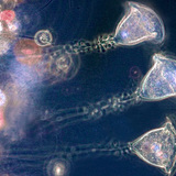 Vorticelas (protozoários unicelulares de água doce)