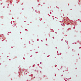 Gonorrhea pathogen, Neisseria gonorrhoeae