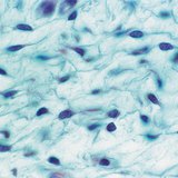 Tejido conectivo laxo