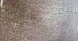 Córtex cerebral humano com as diferentes camadas celulares