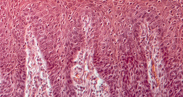 Seção transversal da língua humana