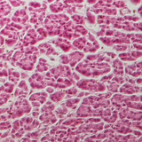 Section of pancreas