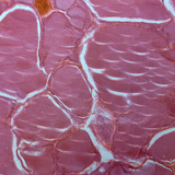 Sección de la glándula tiroides