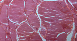 Seção da glândula tireóide