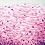 Epitelio escamoso estratificado no queratinizado