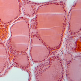 Corte da glândula tiróide