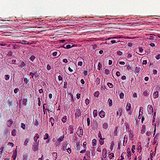 Epitelio escamoso estratificado queratinizado