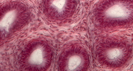 Seção de túbulos seminíferos