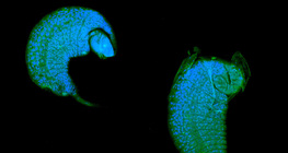 Larva de vespa Iichneumon em desenvolvimento como parasita em pupas de drosophila