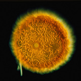 Gémula de la esponja lacustre (Spongilla lacustris)