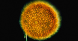 Sponge gemmule (Spongilla lacustris)