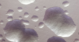 Colônias de bactérias E. coli (não coradas, brancas)