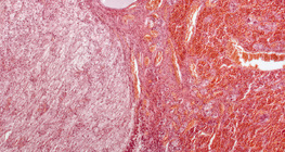 Glândula pituitária (corte longitudinal, baixa ampliação)