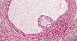 Secção transversal do ovário (mamífero)